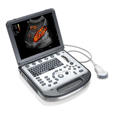 National Ultrasound - Mindray - M6 - Ultrasound System Mindray