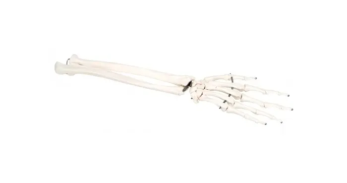 Fabrication Enterprises - 12-4581L - Anatomical Model - loose bones, hand skeleton with ulna and radius, left (wire)