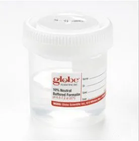 Globe Scientific - 6525FL - Pre-filled Container With Click Close Lid: Tite-rite, Wide Mouth, Pp, Filled With 45ml Of 10% Neutral Buffered Formalin, Attached Hazard Label