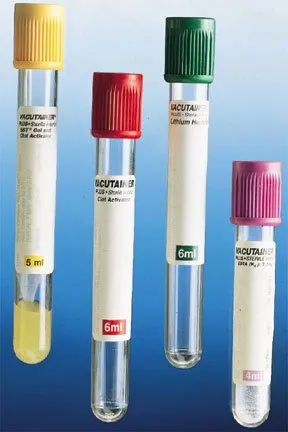 Fisher Scientific - BD Vacutainer SPC Plus - 14816154 - BD Vacutainer SPC Plus Venous Blood Collection Tube Clot Activator Additive 6 mL BD Hemogard Closure Polyethylene Tube