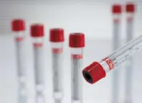 Greiner Bio-One - VACUETTE Z Serum Sep Clot Activator - 454067P -   Venous Blood Collection Tube Clot Activator / Separator Gel Additive 3.5 mL Pull Cap Polyethylene Terephthalate (PET) Tube
