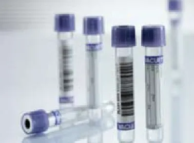 Greiner Bio-One - Vacuette - 455036 - Vacuette Venous Blood Collection Tube K3 Edta Additive 9 Ml Pull Cap Polyethylene Terephthalate (pet) Tube