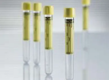 Greiner Bio-One - Vacuette - 455028 - VACUETTE Urinalysis Tube Conical Bottom Plain 16 X 100 mm 9.5 mL Yellow Pull Cap Polyethylene Terephthalate (PET) Tube