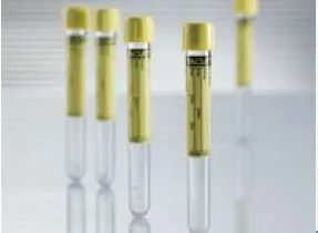 Greiner Bio-One - Vacuette - 456007 - VACUETTE Urinalysis Tube Round Bottom Plain 13 X 100 mm 6.5 mL Yellow Screw Cap Polyethylene Terephthalate (PET) Tube