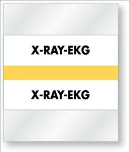 United Ad Label - ULCD27 - Pre-printed Label Laboratory Use White Paper X-ray Ekg Black Lab / Specimen 1-1/2 X 1-1/4 Inch